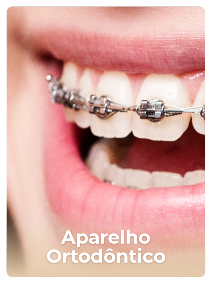 Procedimento de Lipo de Papada